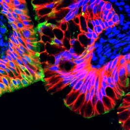 IHH Antibody - Wallaby colon tissue immunolabelled with anti-IHH (green) and anti-Ecadherin (red) showing reactivity in differentiated enterocytes, as per van den Brink et al., 2004-Nature Genetics.  - Wallaby colon tissue immunolabelled with anti-IHH (green) and anti-Ecadherin (red) showing reactivity in differentiated enterocytes, as per van den Brink et al., 2004-Nature Genetics. 