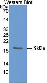 IHH Antibody - Western Blot; Sample: Recombinant protein.