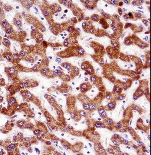 IHH Antibody - IHH Antibody immunohistochemistry of formalin-fixed and paraffin-embedded human liver tissue followed by peroxidase-conjugated secondary antibody and DAB staining.