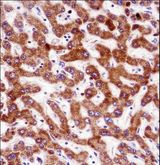 IHH Antibody - IHH Antibody immunohistochemistry of formalin-fixed and paraffin-embedded human liver tissue followed by peroxidase-conjugated secondary antibody and DAB staining.