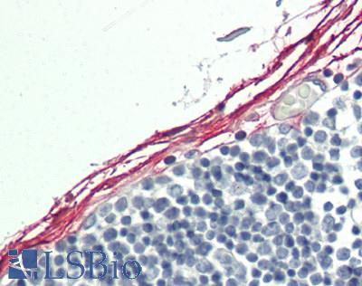 IHH Antibody - Human Fibroblasts: Formalin-Fixed, Paraffin-Embedded (FFPE).  This image was taken for the unconjugated form of this product. Other forms have not been tested.