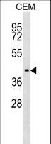 IHH Antibody - IHH antibody western blot of CEM cell line lysates (35 ug/lane). The IHH antibody detected the IHH protein (arrow).