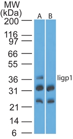 Iigp1 Antibody - Western blot of Iigp1 using Iigp1 polyclonal antibody. Mouse NIH 3T3 lysate in the absence (A) and presence (B) of immunizing peptide probed with Iigp1 antibody at 4 ug/ml. Goat anti-rabbit Ig HRP secondary antibody, and PicoTect ECL substrate solution, were used for this test.