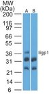 Iigp1 Antibody - Western blot of Iigp1 using Iigp1 polyclonal antibody. Mouse NIH 3T3 lysate in the absence (A) and presence (B) of immunizing peptide probed with Iigp1 antibody at 4 ug/ml. Goat anti-rabbit Ig HRP secondary antibody, and PicoTect ECL substrate solution, were used for this test.