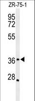 IIP45 / MIIP Antibody - Western blot of MIIP Antibody in ZR-75-1 cell line lysates (35 ug/lane). MIIP (arrow) was detected using the purified antibody.