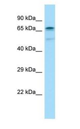 IK3-1 / CABLES1 Antibody - IK3-1 / CABLES1 antibody Western Blot of Fetal Heart.  This image was taken for the unconjugated form of this product. Other forms have not been tested.