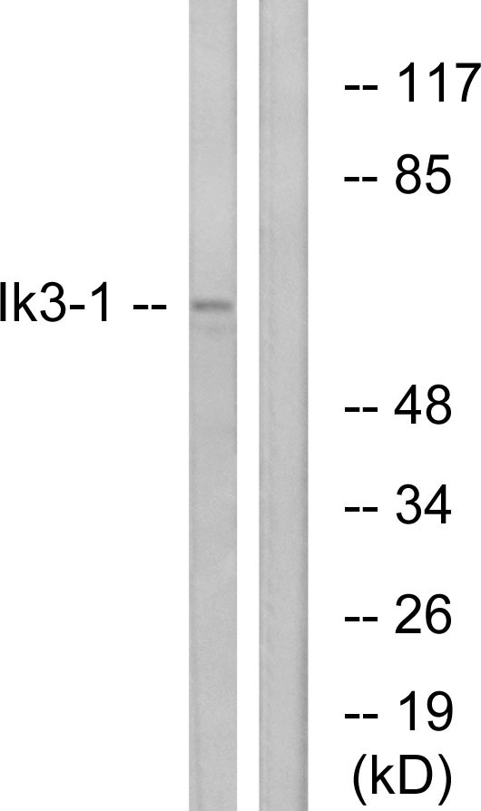 IK3-1 / CABLES1 Antibody - Western blot analysis of lysates from LOVO cells, using Ik3-1 Antibody. The lane on the right is blocked with the synthesized peptide.