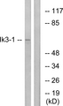 IK3-1 / CABLES1 Antibody - Western blot analysis of lysates from LOVO cells, using Ik3-1 Antibody. The lane on the right is blocked with the synthesized peptide.
