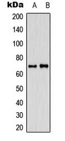 IK3-1 / CABLES1 Antibody - Western blot analysis of CABLES1 expression in SHSY5Y (A); HeLa (B) whole cell lysates.