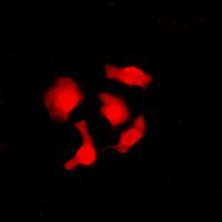 IK3-1 / CABLES1 Antibody - Immunofluorescent analysis of CABLES1 staining in SHSY5Y cells. Formalin-fixed cells were permeabilized with 0.1% Triton X-100 in TBS for 5-10 minutes and blocked with 3% BSA-PBS for 30 minutes at room temperature. Cells were probed with the primary antibody in 3% BSA-PBS and incubated overnight at 4 C in a humidified chamber. Cells were washed with PBST and incubated with a DyLight 594-conjugated secondary antibody (red) in PBS at room temperature in the dark. DAPI was used to stain the cell nuclei (blue).