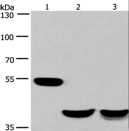 IK3-1 / CABLES1 Antibody - Western blot analysis of Mouse brain and human fetal muscle tissue, mouse heart tissue, using CABLES1 Polyclonal Antibody at dilution of 1:650.