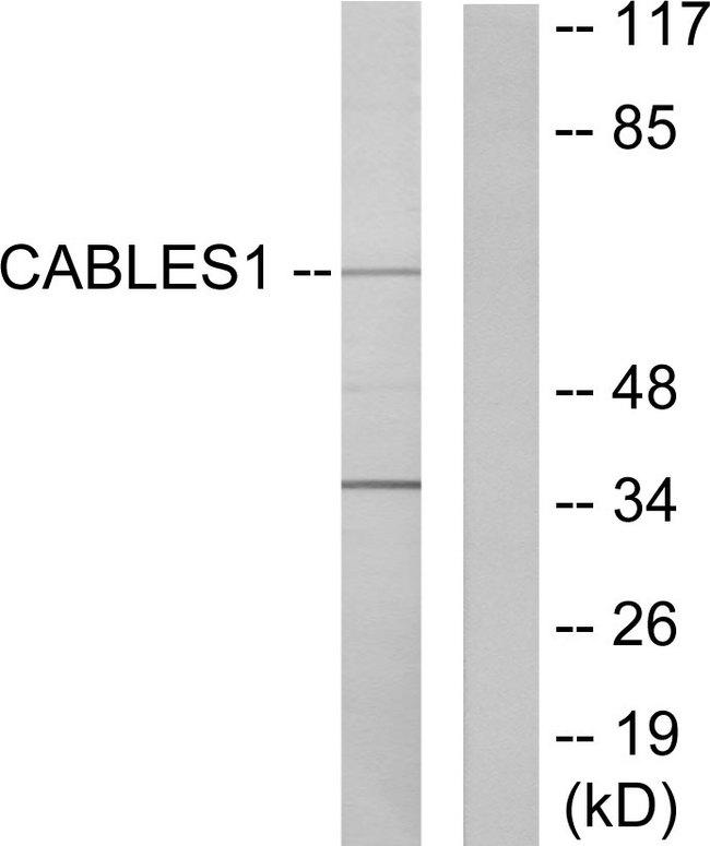 IK3-1 / CABLES1 Antibody - Western blot analysis of extracts from LOVO cells, using Ik3-1 antibody.