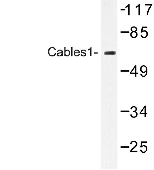 IK3-1 / CABLES1 Antibody - Western blot of Cables1 (K588) pAb in extracts from LOVO cells.