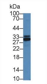 IKBIP Antibody - Western Blot; Sample: Mouse Liver lysate; Primary Ab: 2µg/mL Rabbit Anti-Human IKBIP Antibody Second Ab: 0.2µg/mL HRP-Linked Caprine Anti-Rabbit IgG Polyclonal Antibody