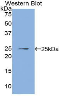 IKBIP Antibody - Western blot of recombinant IKBIP.