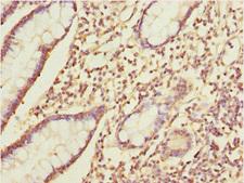 IKBIP Antibody - Immunohistochemistry of paraffin-embedded human small intestine at dilution 1:100