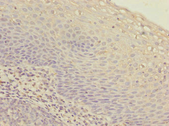 IKBIP Antibody - Immunohistochemistry of paraffin-embedded human tonsil tissue at dilution 1:100