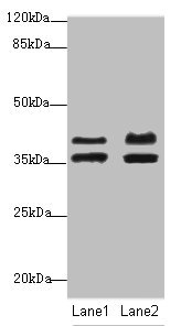 IKBIP Antibody - Western blot All Lanes: IKBIPantibody at 2.23ug/ml Lane 1: Mouse kidney tissue Lane 2: HL60 whole cell lysate Secondary Goat polyclonal to Rabbit IgG at 1/10000 dilution Predicted band size: 40,28,8,44 kDa Observed band size: 39 kDa,36 kDa