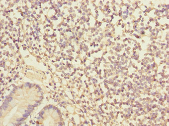 IKBIP Antibody - Immunohistochemistry of paraffin-embedded human small intestine at dilution 1:100