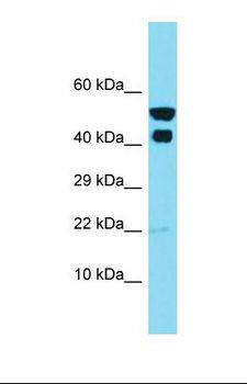 IKBIP Antibody - Western blot of Human ACHN. IKBIP antibody dilution 1.0 ug/ml.  This image was taken for the unconjugated form of this product. Other forms have not been tested.