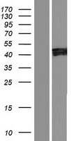 IKBIP Protein - Western validation with an anti-DDK antibody * L: Control HEK293 lysate R: Over-expression lysate