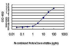 IKBKAP / IKAP Antibody - Detection limit for recombinant GST tagged IKBKAP is approximately 0.3 ng/ml as a capture antibody.