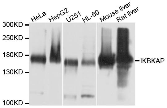IKBKAP / IKAP Antibody - Western blot analysis of extracts of various cell lines, using IKBKAP antibody at 1:1000 dilution. The secondary antibody used was an HRP Goat Anti-Rabbit IgG (H+L) at 1:10000 dilution. Lysates were loaded 25ug per lane and 3% nonfat dry milk in TBST was used for blocking. An ECL Kit was used for detection and the exposure time was 10s.