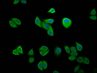 IKBKAP / IKAP Antibody - Immunofluorescence staining of Hela cells diluted at 1:200, counter-stained with DAPI. The cells were fixed in 4% formaldehyde, permeabilized using 0.2% Triton X-100 and blocked in 10% normal Goat Serum. The cells were then incubated with the antibody overnight at 4°C.The Secondary antibody was Alexa Fluor 488-congugated AffiniPure Goat Anti-Rabbit IgG (H+L).