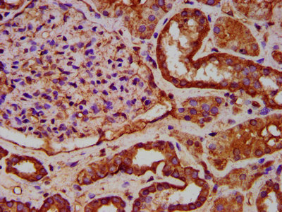 IKBKAP / IKAP Antibody - Immunohistochemistry Dilution at 1:600 and staining in paraffin-embedded human kidney tissue performed on a Leica BondTM system. After dewaxing and hydration, antigen retrieval was mediated by high pressure in a citrate buffer (pH 6.0). Section was blocked with 10% normal Goat serum 30min at RT. Then primary antibody (1% BSA) was incubated at 4°C overnight. The primary is detected by a biotinylated Secondary antibody and visualized using an HRP conjugated SP system.