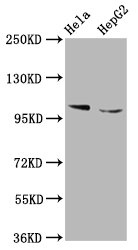 IKBKAP / IKAP Antibody - Western Blot Positive WB detected in: Hela whole cell lysate, HepG2 whole cell lysate All Lanes: IKBKAP antibody at 5.3µg/ml Secondary Goat polyclonal to rabbit IgG at 1/50000 dilution Predicted band size: 151 KDa Observed band size: 151 KDa