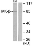 IKBKB / IKK2 / IKK Beta Antibody - Western blot of extracts from 293 cells, treated with LPS 100 ng/ml 30', using IKK-beta (Ab-188) Antibody. The lane on the right is treated with the synthesized peptide.