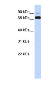IKBKB / IKK2 / IKK Beta Antibody - IKBKB / IKK Beta antibody Western blot of Fetal Brain lysate. This image was taken for the unconjugated form of this product. Other forms have not been tested.