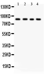 IKBKB / IKK2 / IKK Beta Antibody - IKK beta antibody Western blot. All lanes: Anti IKK beta at 0.5 ug/ml. Lane 1: HEPG2 Whole Cell Lysate at 40 ug. Lane 2: COLO320 Whole Cell Lysate at 40 ug. Lane 3: M231 Whole Cell Lysate at 40 ug. Lane 4: HT1080 Whole Cell Lysate at 40 ug. Predicted band size: 87 kD. Observed band size: 87 kD.
