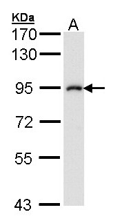IKBKB / IKK2 / IKK Beta Antibody - Sample (30 ug of whole cell lysate). A: A431 . 7.5% SDS PAGE. IKK2 / IKK Beta antibody diluted at 1:1000.