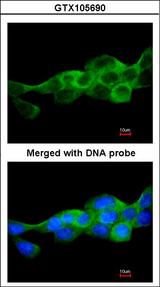 IKBKB / IKK2 / IKK Beta Antibody - Immunofluorescence of paraformaldehyde-fixed A431 using IKK beta antibody at 1:200 dilution.