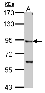 IKBKB / IKK2 / IKK Beta Antibody - IKK beta antibody detects IKBKB protein by Western blot analysis. A. 30 ug PC-12 whole cell lysate/extract. 7.5 % SDS-PAGE. IKK beta antibody dilution:1:1000