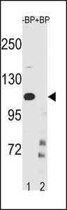IKBKB / IKK2 / IKK Beta Antibody - IKKB Antibody (Center Y609) western blot of CEM cell line lysates (35 ug/lane). The IKKB antibody detected the IKKB protein (arrow).