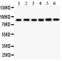 IKBKB / IKK2 / IKK Beta Antibody - IKBKB antibody Western blot. All lanes: Anti IKBKB at 0.5 ug/ml. Lane 1: Rat Cardiac Muscle Tissue Lysate at 50 ug. Lane 2: Rat Skeletal Muscle Tissue Lysate at 50 ug. Lane 3: PANC Whole Cell Lysate at 40 ug. Lane 4: MCF-7Whole Cell Lysate at 40 ug. Lane 5: HEPG2 Whole Cell Lysate at 40 ug. Lane 6: COLO320 Cell Lysate at 40 ug. Predicted band size: 87 kD. Observed band size: 87 kD.