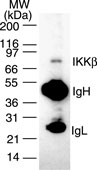 IKBKB / IKK2 / IKK Beta Antibody - antibody was used to immunoprecipitate IKKb from 1x10^6 Daudi cells and the immuno-precipitated protein was detected by western blotting using antibody. IKKb was detected as a protein of ~87 kD.