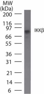 IKBKB / IKK2 / IKK Beta Antibody - Western blot of IKKb in Daudi cell lysate using antibody at5 ug/ml.