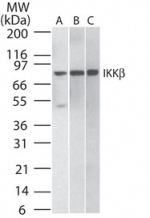 IKBKB / IKK2 / IKK Beta Antibody - Western blot of 30 ug of total cell lysate from A) Daudi, B) HeLa, and C) mouse NIH 3T3 cells using antibody at 2 ug/ml dilution.