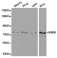 IKBKB / IKK2 / IKK Beta Antibody - Western blot of extracts of various cell lines, using IKK beta antibody.