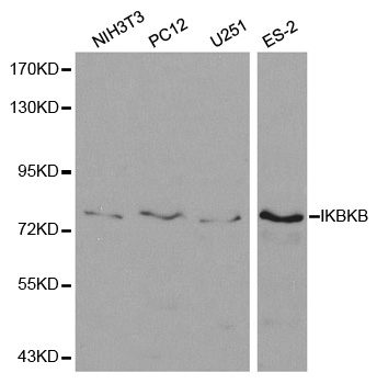 IKBKB / IKK2 / IKK Beta Antibody - Western blot analysis of extracts of various cell lines.