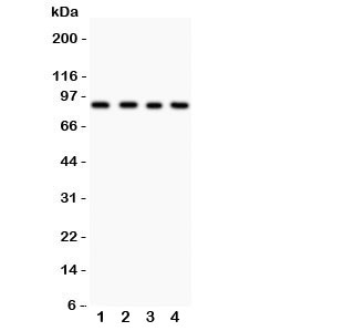 IKBKB / IKK2 / IKK Beta Antibody - Western blot testing of IKKb antibody and Lane 1: HEPG2; 2: COLO320; 3: M231; 4: HT1080 lysate. Expected/observed size ~87KD