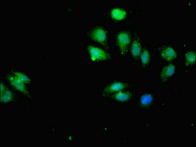 IKBKB / IKK2 / IKK Beta Antibody - Immunofluorescent analysis of A549 cells at a dilution of 1:100 and Alexa Fluor 488-congugated AffiniPure Goat Anti-Rabbit IgG(H+L)
