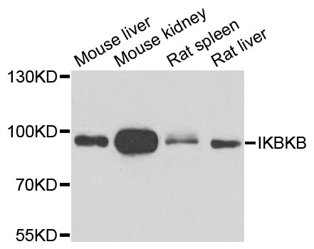 IKBKB / IKK2 / IKK Beta Antibody - Western blot analysis of extracts of various cell lines, using IKBKB antibody at 1:1000 dilution. The secondary antibody used was an HRP Goat Anti-Rabbit IgG (H+L) at 1:10000 dilution. Lysates were loaded 25ug per lane and 3% nonfat dry milk in TBST was used for blocking. An ECL Kit was used for detection and the exposure time was 60s.