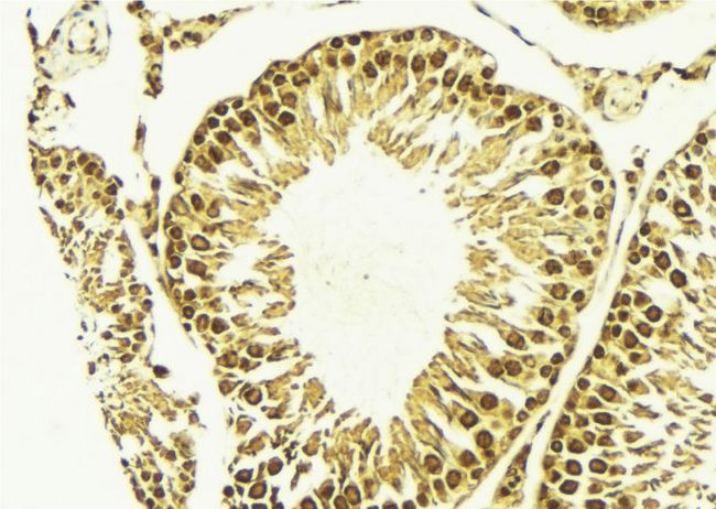 IKBKB / IKK2 / IKK Beta Antibody - 1:100 staining mouse testis tissue by IHC-P. The sample was formaldehyde fixed and a heat mediated antigen retrieval step in citrate buffer was performed. The sample was then blocked and incubated with the antibody for 1.5 hours at 22°C. An HRP conjugated goat anti-rabbit antibody was used as the secondary.