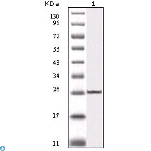 IKBKB / IKK2 / IKK Beta Antibody - Western Blot (WB) analysis using IKKbeta Monoclonal Antibody against truncated IKKbeta recombinant protein (1).