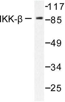IKBKB / IKK2 / IKK Beta Antibody - Western blot of IKK- (F182) pAb in extracts from 293 cells treated with LPS 100ng/ml, 30mins.