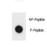 IKBKB / IKK2 / IKK Beta Antibody - Dot blot of IKKB Antibody (Phospho S177) Phospho-specific antibody on nitrocellulose membrane. 50ng of Phospho-peptide or Non Phospho-peptide per dot were adsorbed. Antibody working concentrations are 0.6ug per ml.